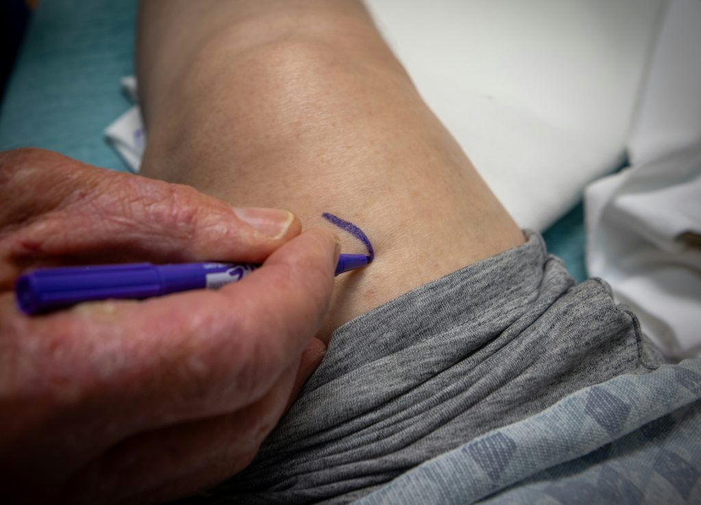 Knee Replacement Surgery